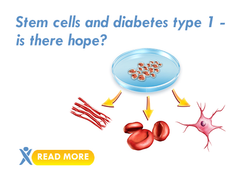 stem cell research on type 1 diabetes